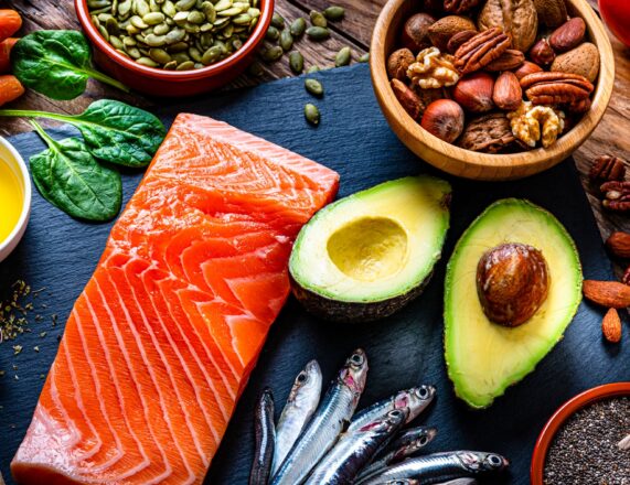 Food Is Not Art, and a Chef, No Matter How Great, Is Not an Artist